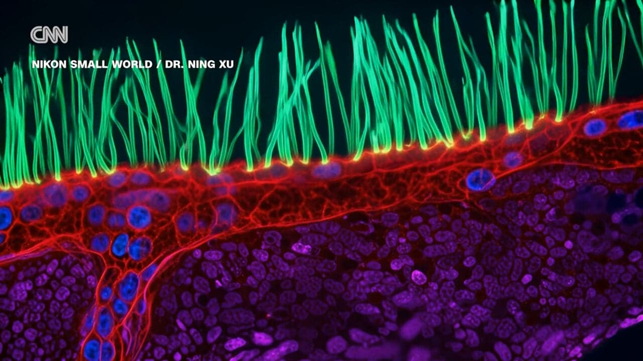 AI Confabulations Plague Contest-Winning Microscope Video, Scientists Say